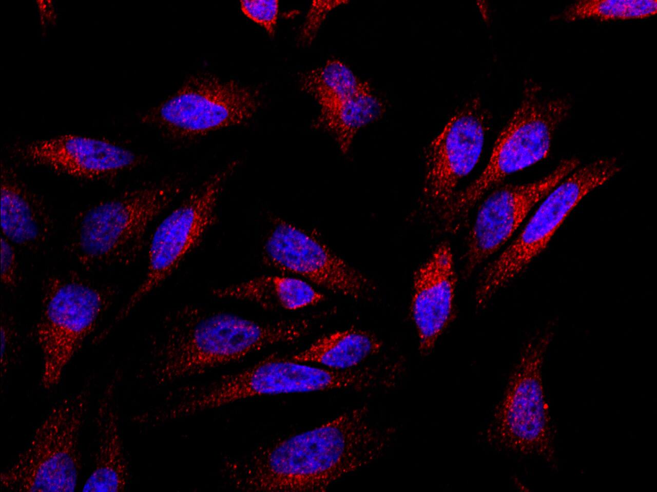 Breast carcinoma amplified sequence 3 Antibody - Azide and BSA Free
