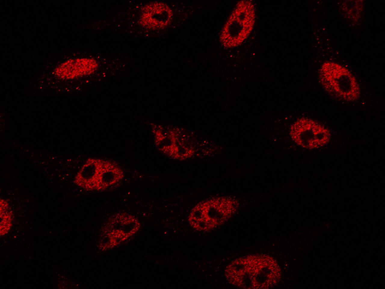 VDR/NR1I1/Vitamin D Receptor Antibody - Azide and BSA Free
