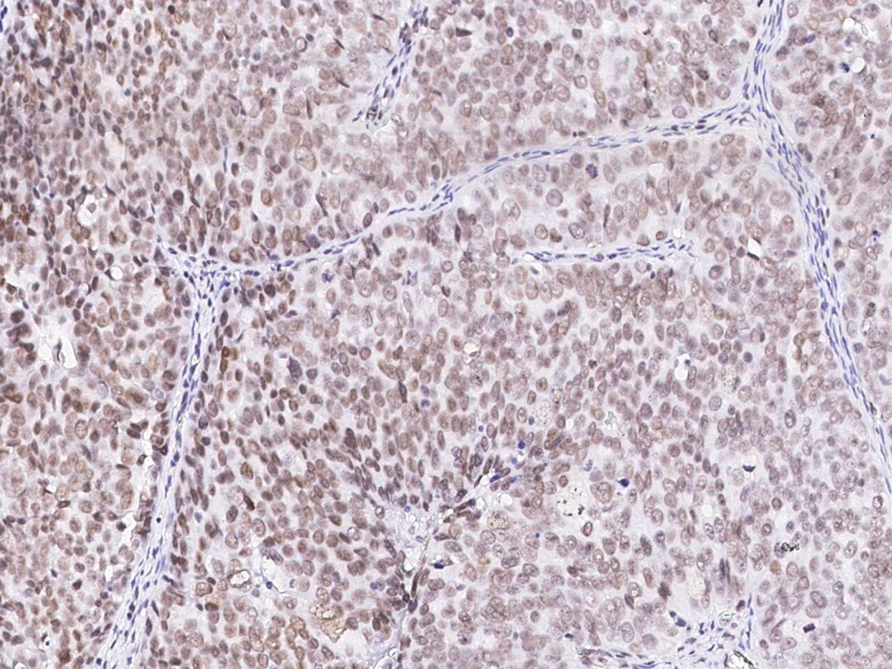 SIN3A Antibody - Azide and BSA Free
