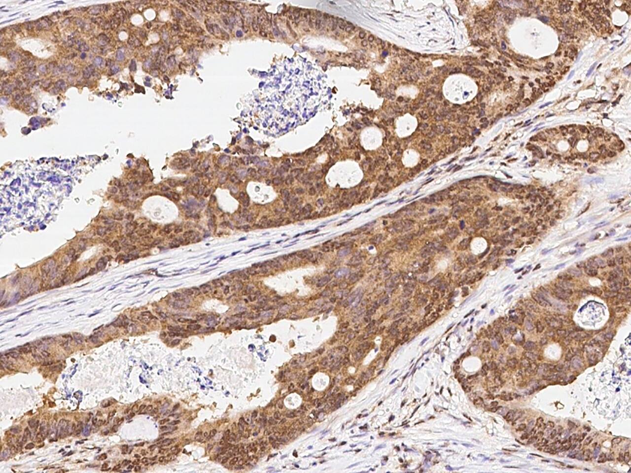 Cdk6 Antibody - Azide and BSA Free