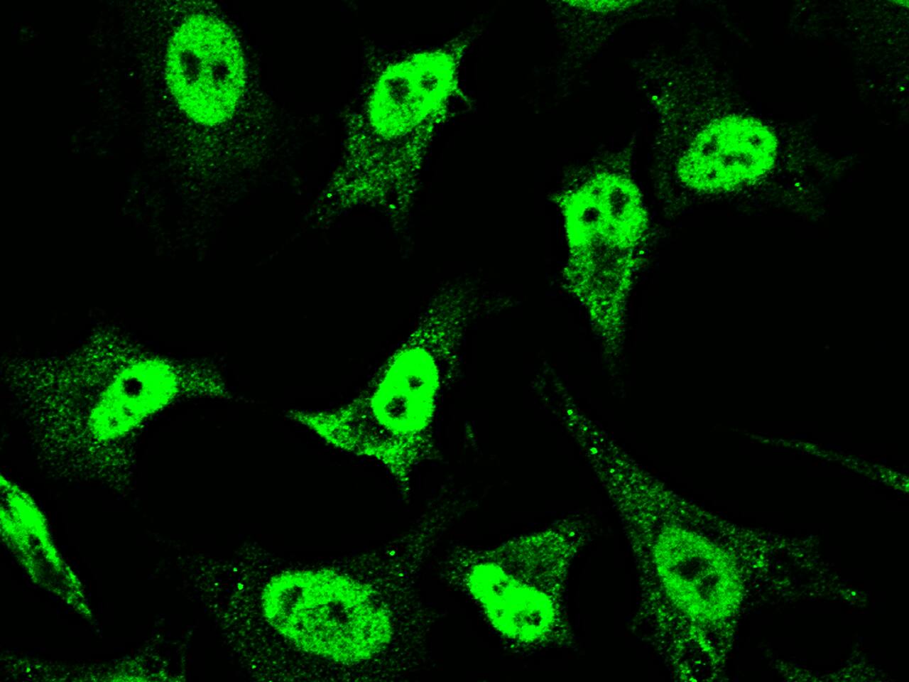 Mineralocorticoid R/NR3C2 Antibody - Azide and BSA Free