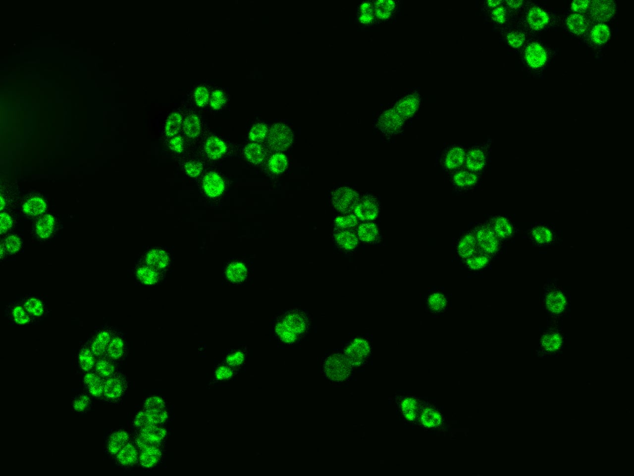 IKK alpha Antibody - Azide and BSA Free