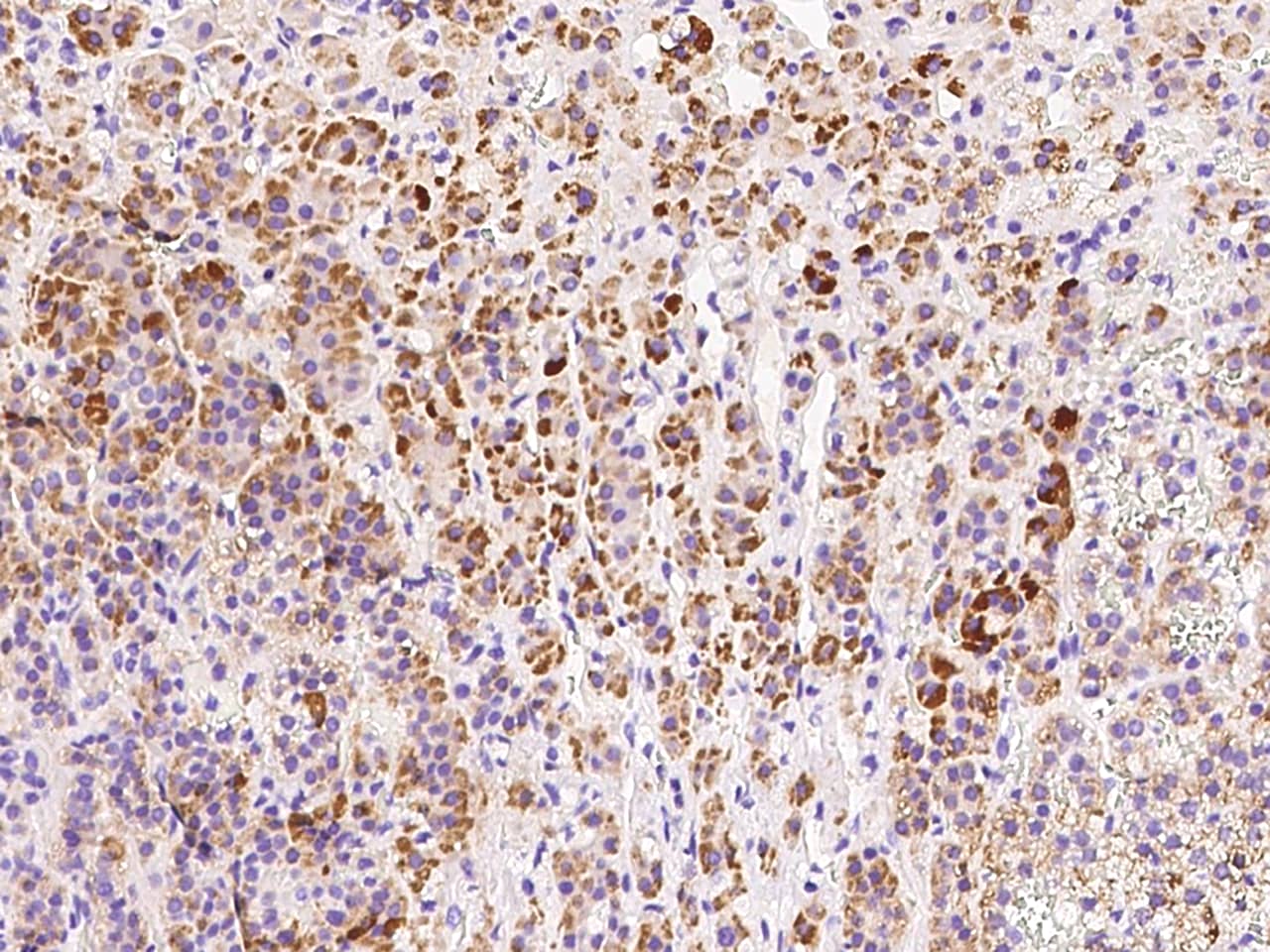 HDHD3 Antibody - BSA Free