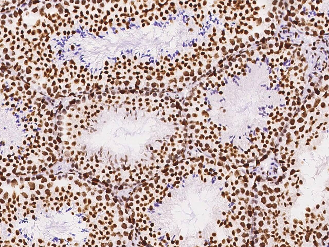 KLF7 Antibody - BSA Free