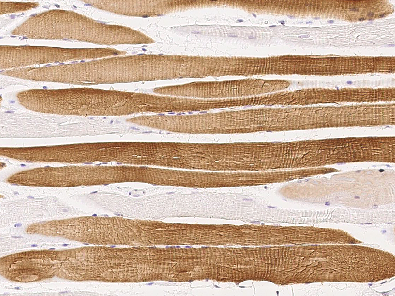 Troponin C (cardiac) Antibody - Azide and BSA Free
