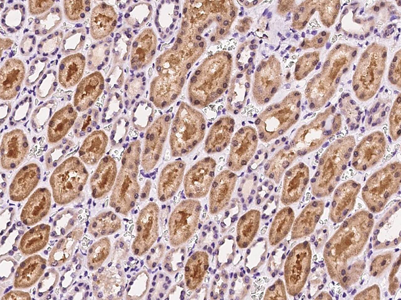 Glutathione Synthetase Antibody - BSA Free