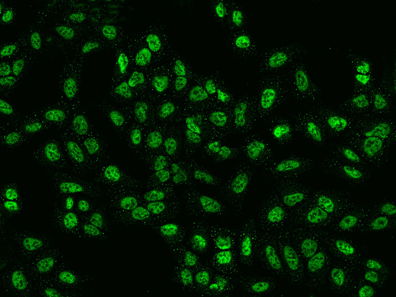 PPP4R2 Antibody - BSA Free