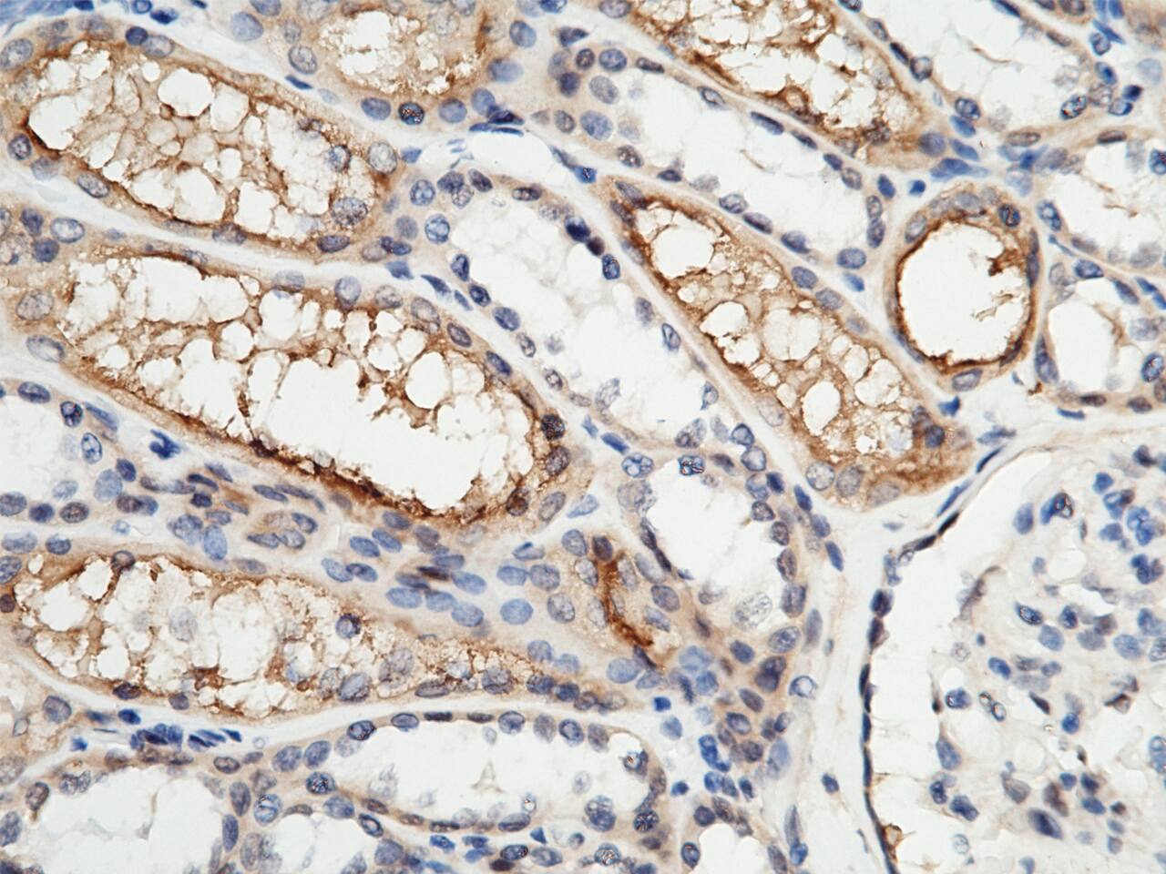 Aminopeptidase P2/XPNPEP2 Antibody - Azide and BSA Free