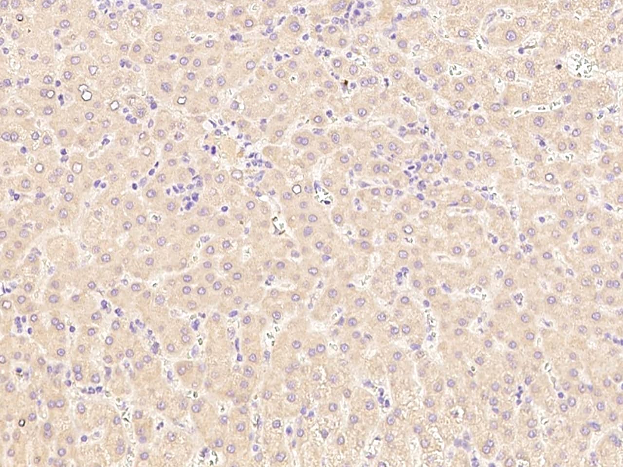 LCAT Antibody - Azide and BSA Free