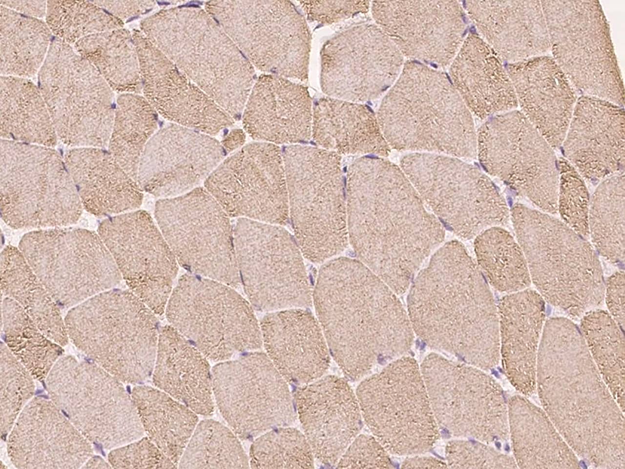 Calsequestrin 1 Antibody - Azide and BSA Free