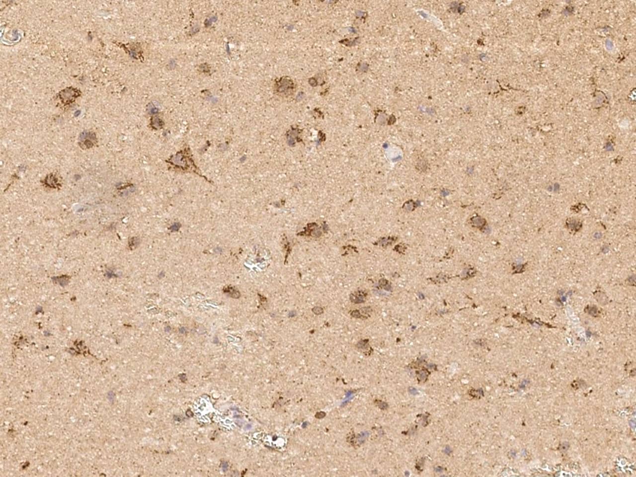 Scn2b Antibody - Azide and BSA Free