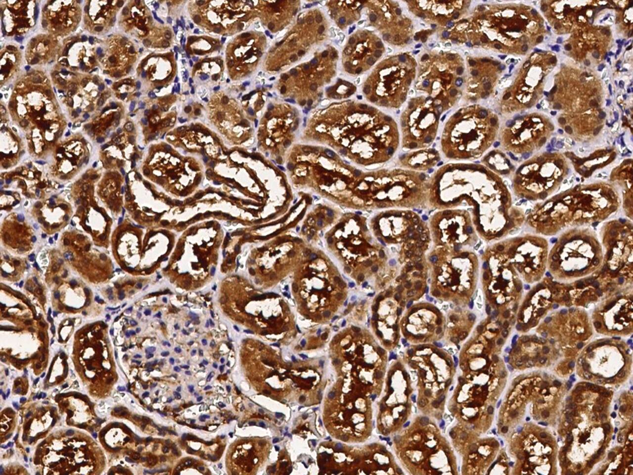 ABHD14B Antibody - Azide and BSA Free