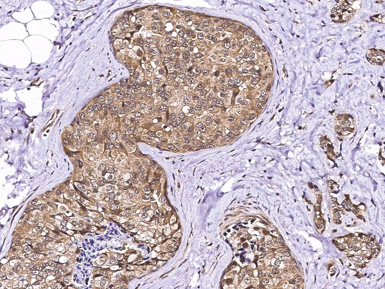 LSM1 Antibody - Azide and BSA Free