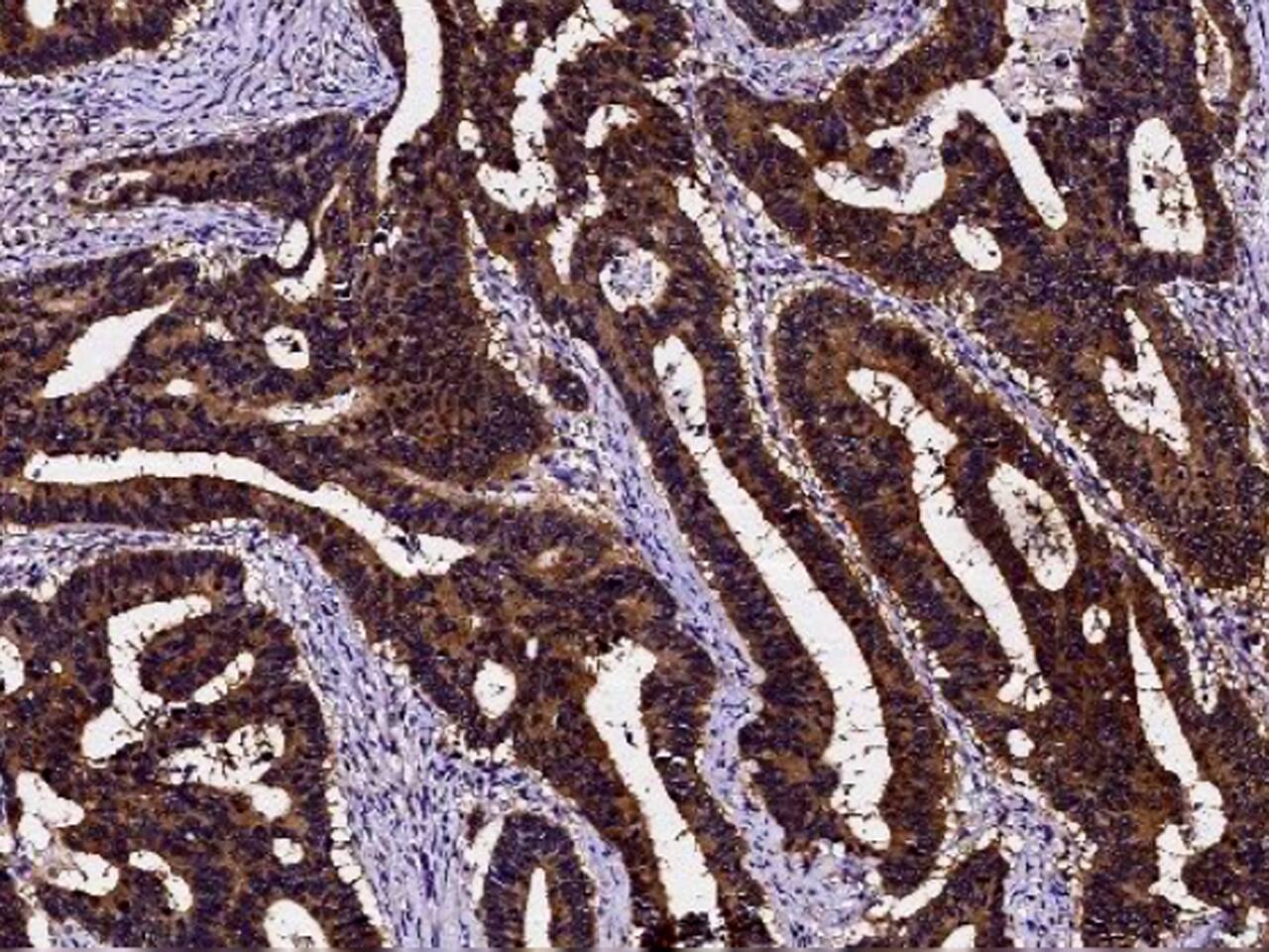 PDRG1 Antibody - Azide and BSA Free