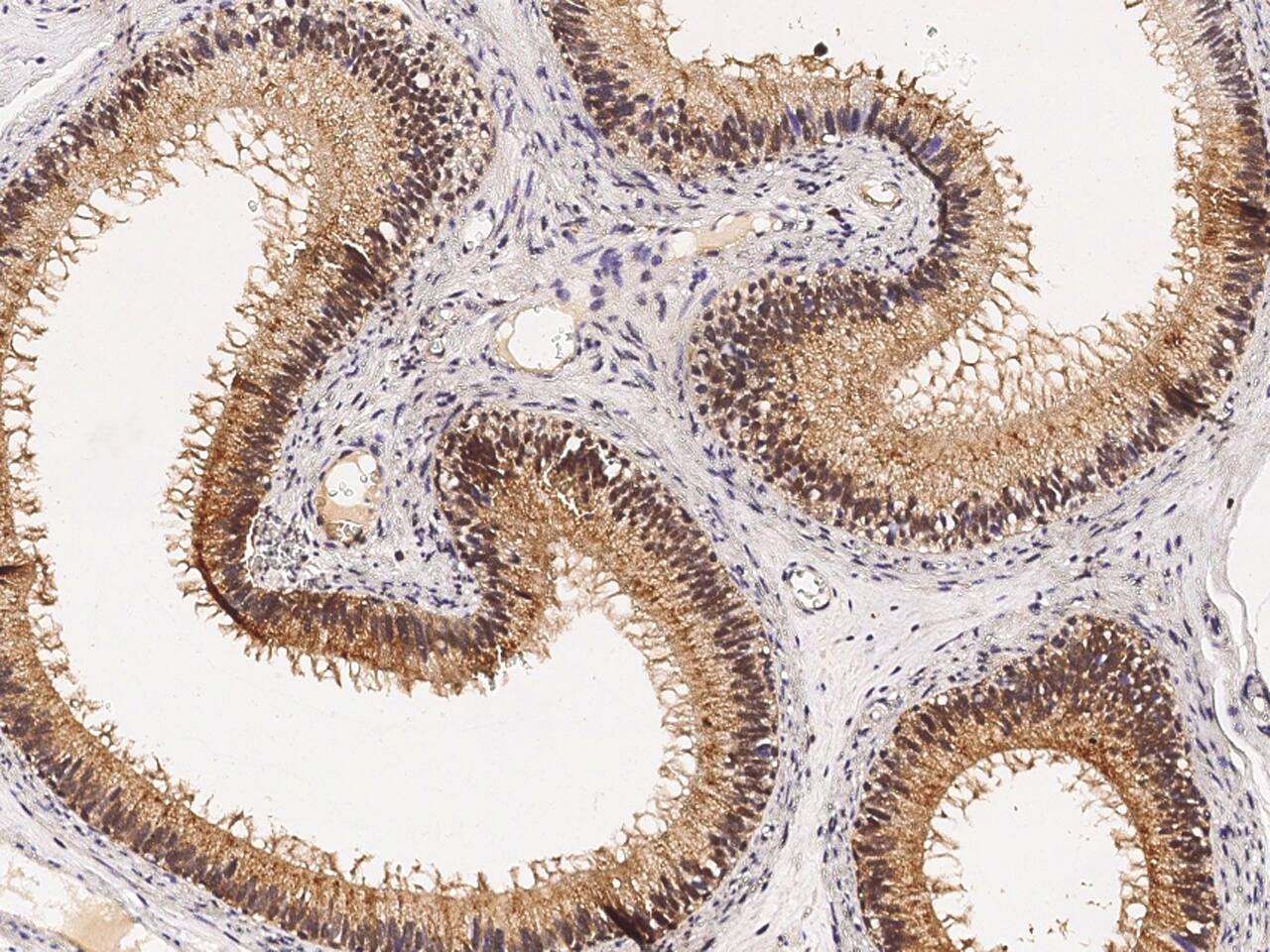 PPIL1 Antibody - Azide and BSA Free
