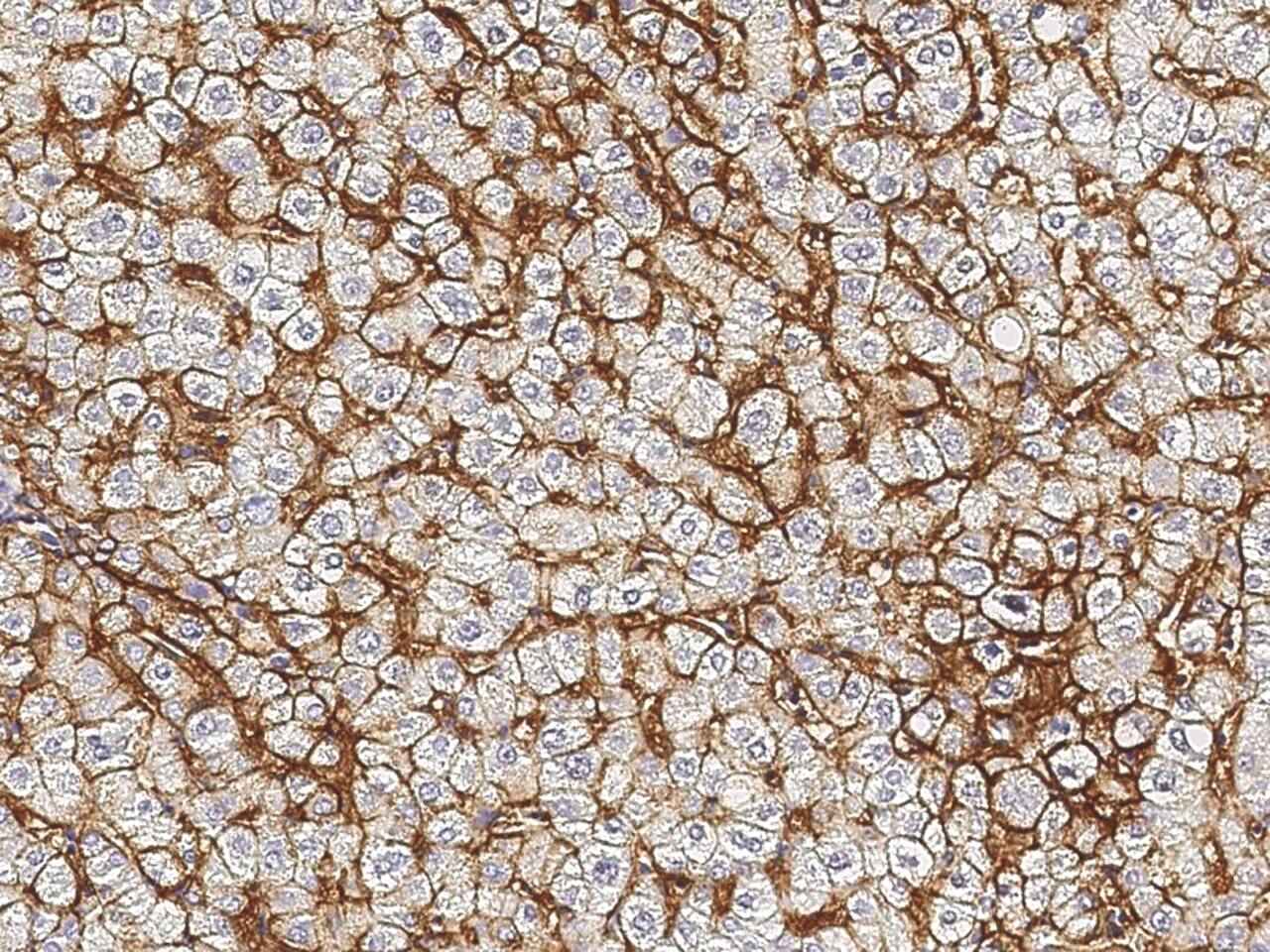 Sodium Potassium ATPase Beta 1 Antibody - Azide and BSA Free