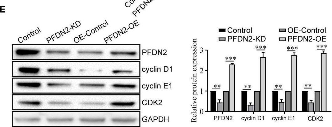 PFDN2 Antibody - Azide and BSA Free