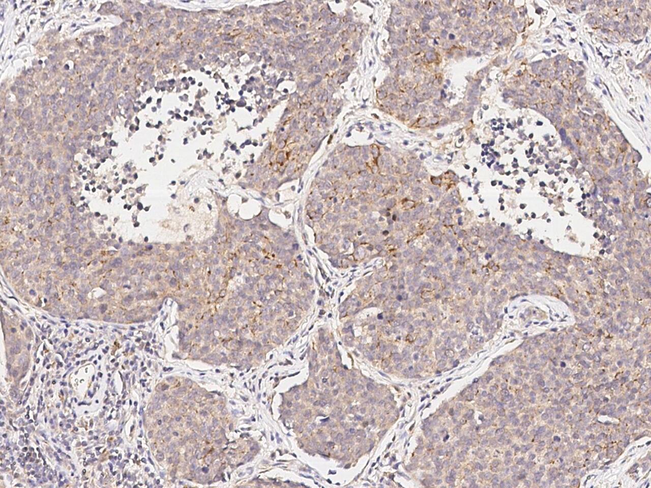 FHIT Antibody - Azide and BSA Free