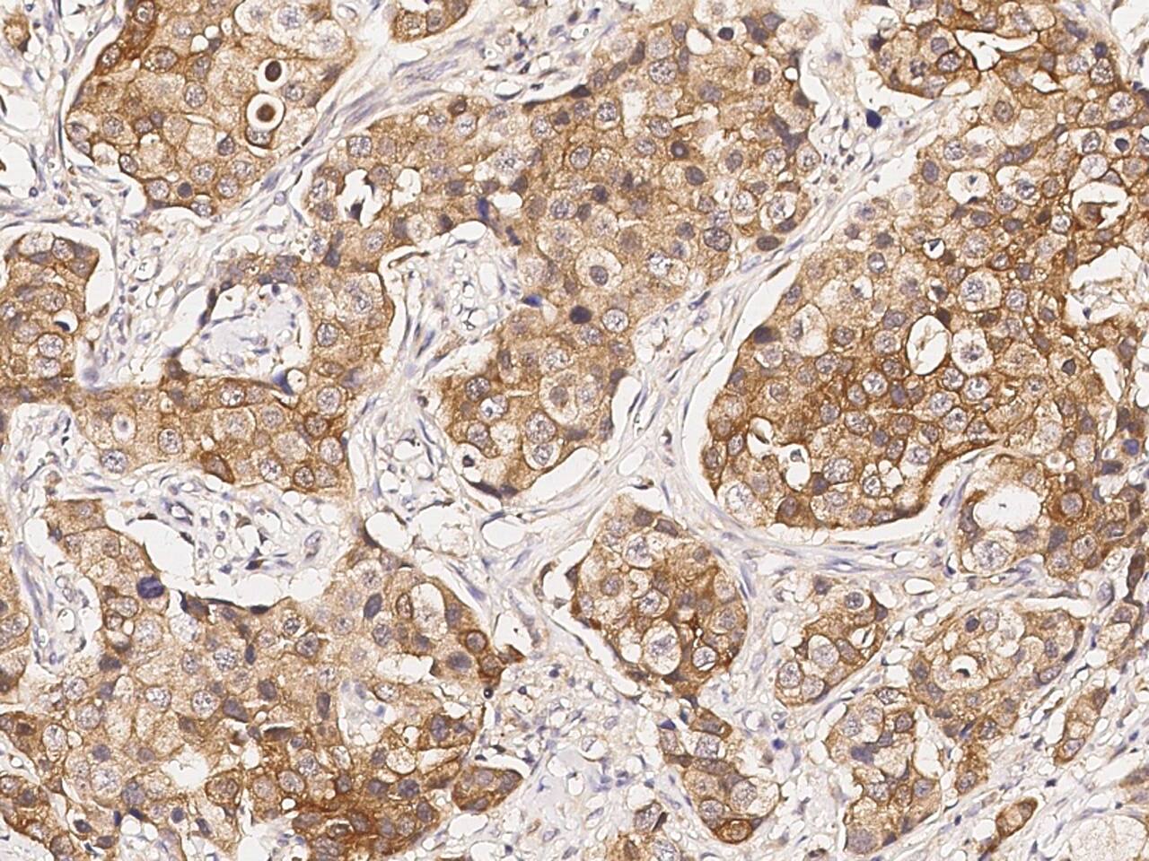 FHIT Antibody - Azide and BSA Free
