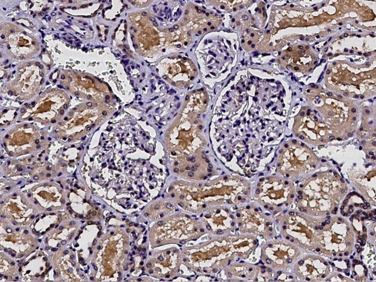 Profilin 2 Antibody - Azide and BSA Free