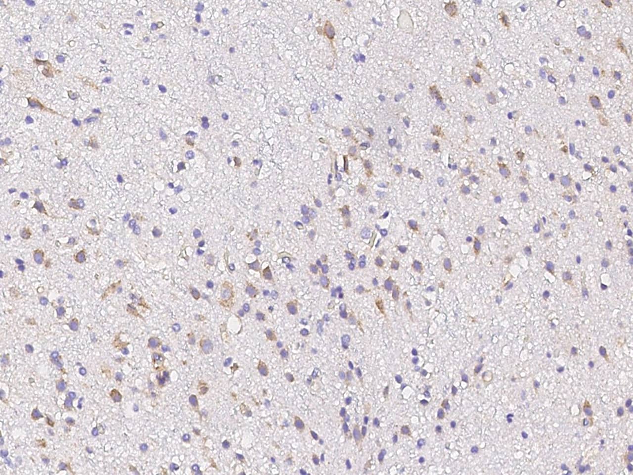 CPLX3 Antibody - Azide and BSA Free