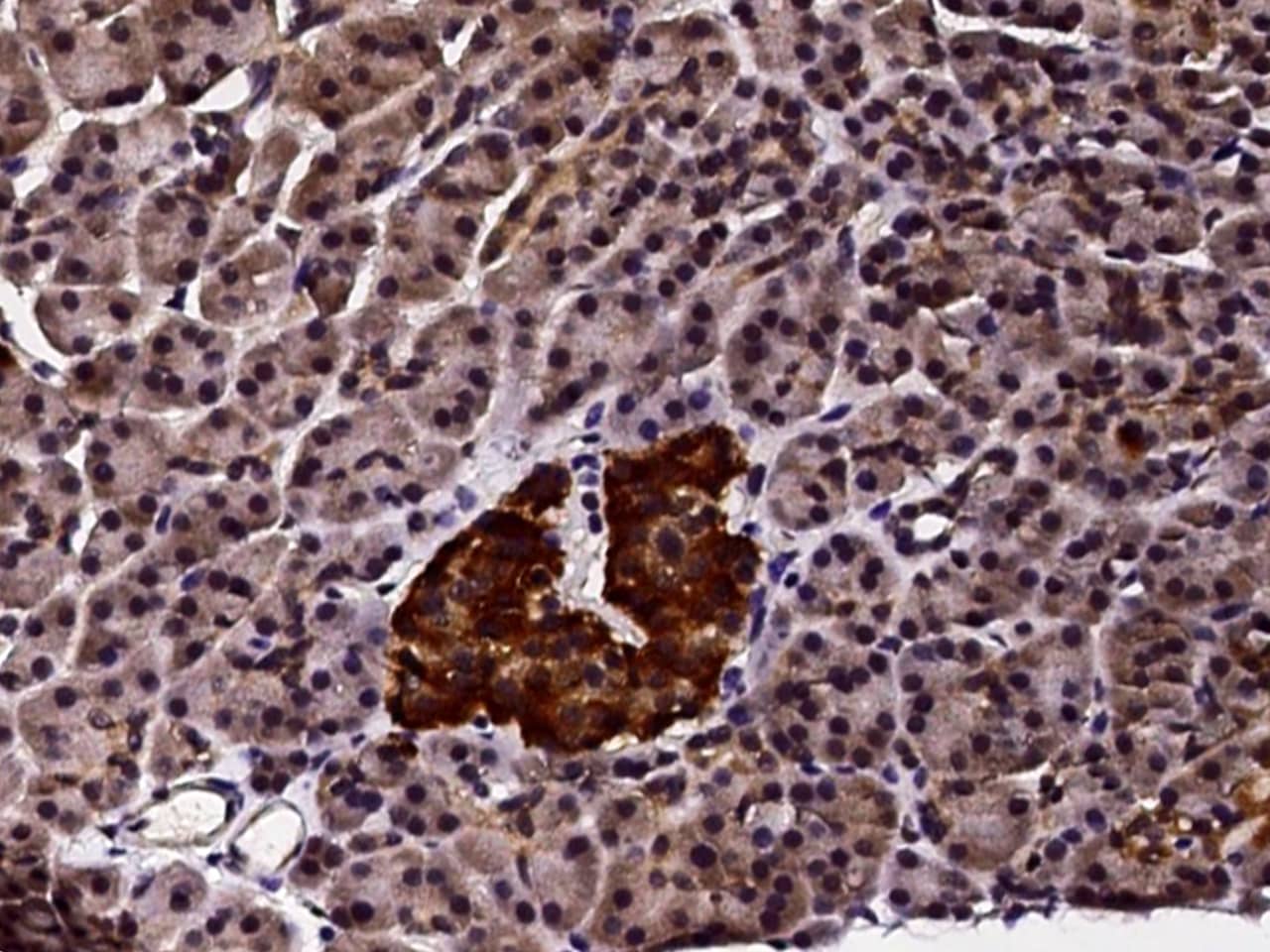 PMVK/phosphomevalonate kinase Antibody - Azide and BSA Free