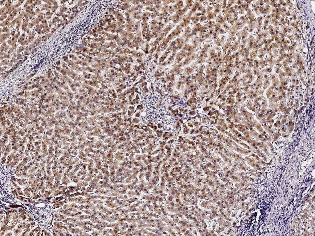 PMVK/phosphomevalonate kinase Antibody - Azide and BSA Free