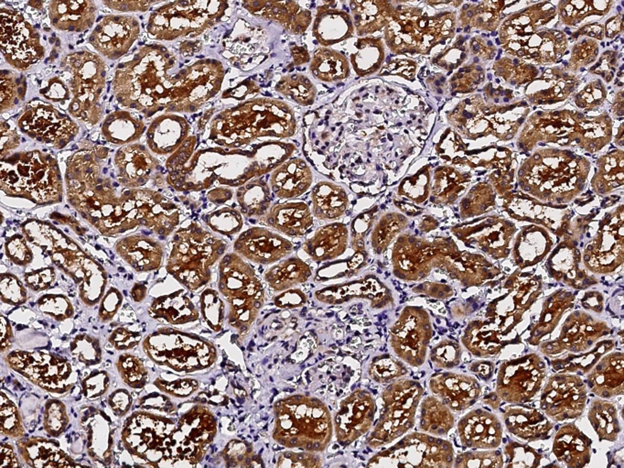 PMVK/phosphomevalonate kinase Antibody - Azide and BSA Free