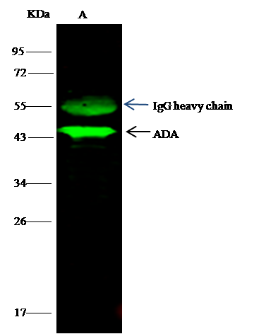 Adenosine Deaminase/ADA Antibody - Azide and BSA Free