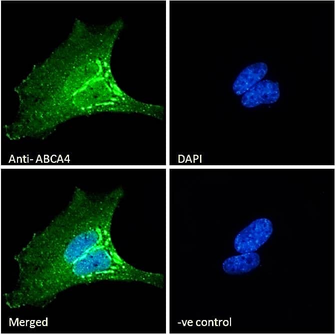 ABCA4 Antibody