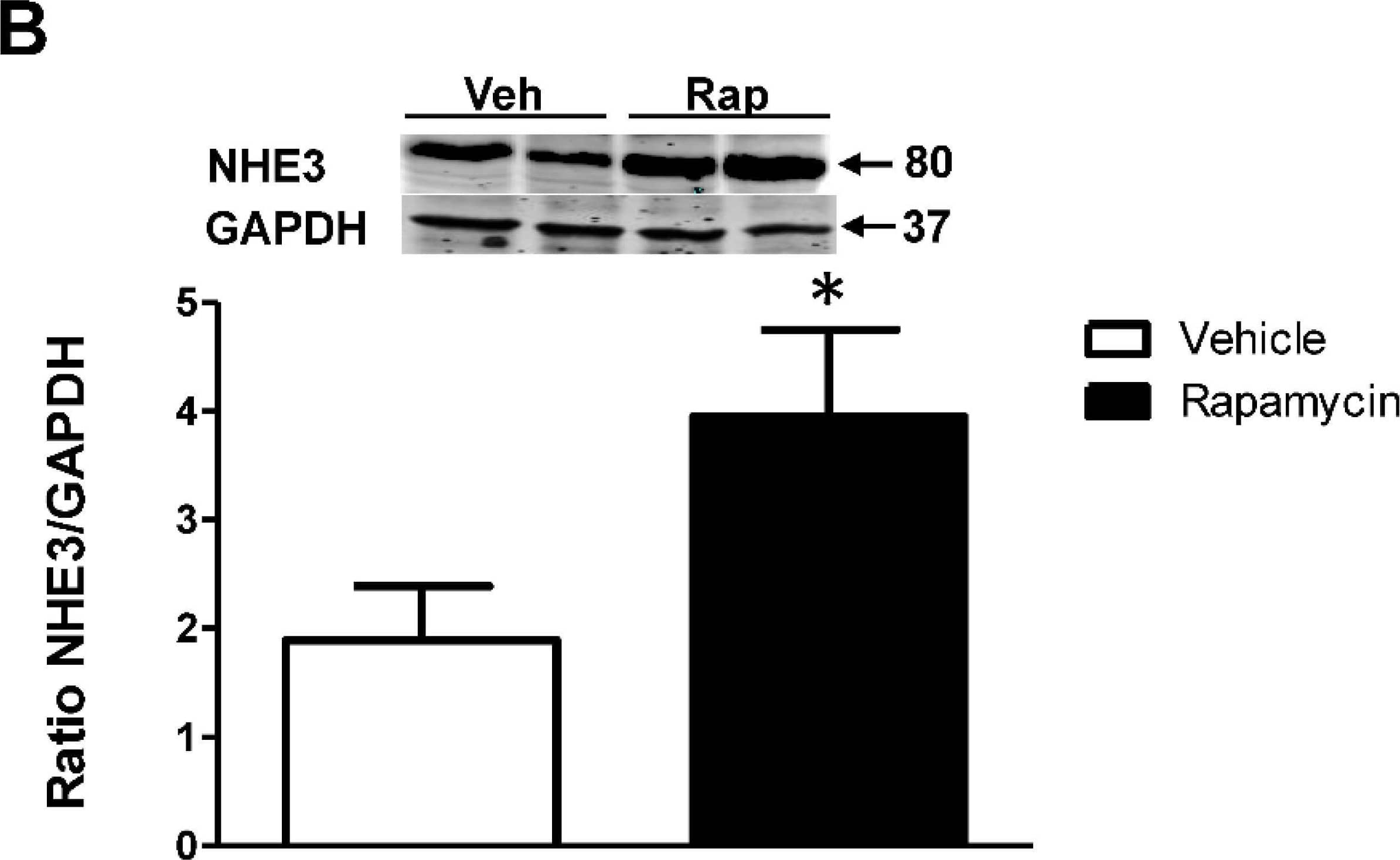 NHE3/SLC9A3 Antibody - BSA Free