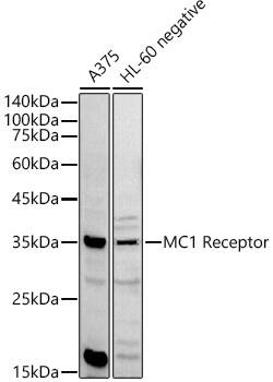 Melanocortin-1 R/MC1R Antibody - Azide and BSA Free