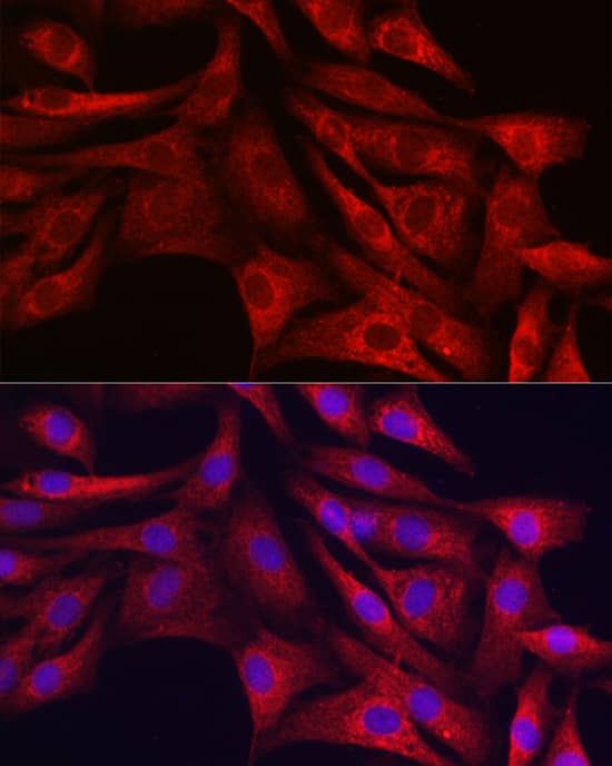 Sirtuin 3/SIRT3 Antibody - Azide and BSA Free