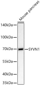 HRD1 Antibody - BSA Free