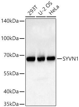 HRD1 Antibody - BSA Free