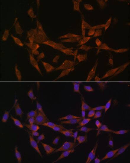 UBE2O Antibody - BSA Free