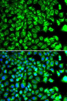 BORCS7 Antibody - BSA Free