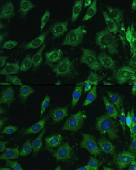 Galectin-3 Antibody - Azide and BSA Free