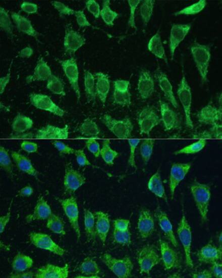 Galectin-3 Antibody - Azide and BSA Free