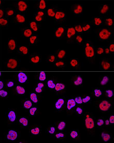 Methyltransferase like 3 Antibody - Azide and BSA Free