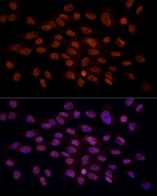 gamma C Crystallin Antibody - BSA Free