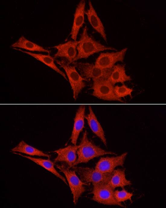 Glucuronosyltransferase 1A1/UGT1A1 Antibody - Azide and BSA Free