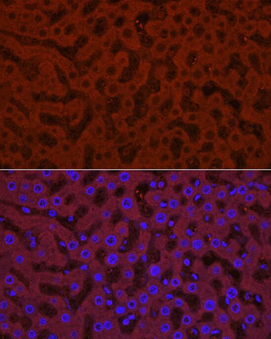Glucuronosyltransferase 1A1/UGT1A1 Antibody - Azide and BSA Free