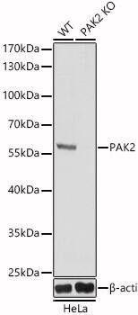 PAK2 Antibody - Azide and BSA Free