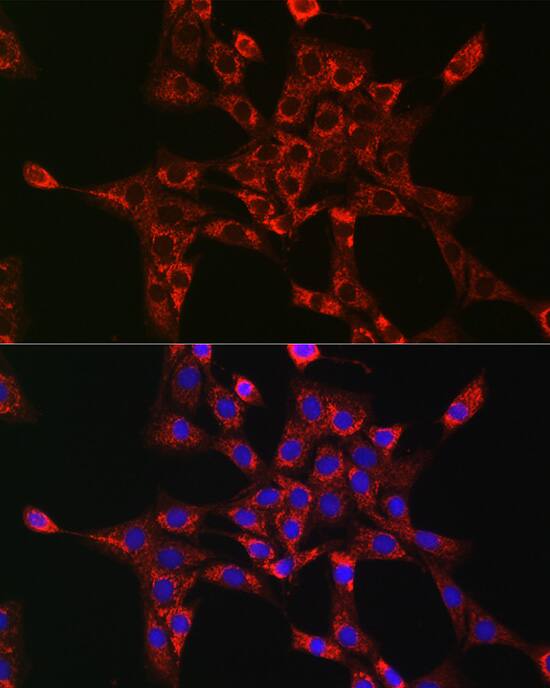 Rab5a Antibody - Azide and BSA Free