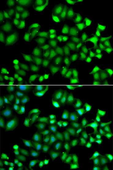 MAPKAP Kinase 3 Antibody - Azide and BSA Free