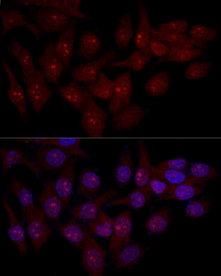 integrin beta 4 binding protein Antibody - BSA Free
