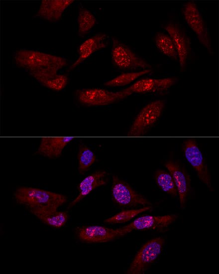 integrin beta 4 binding protein Antibody - BSA Free