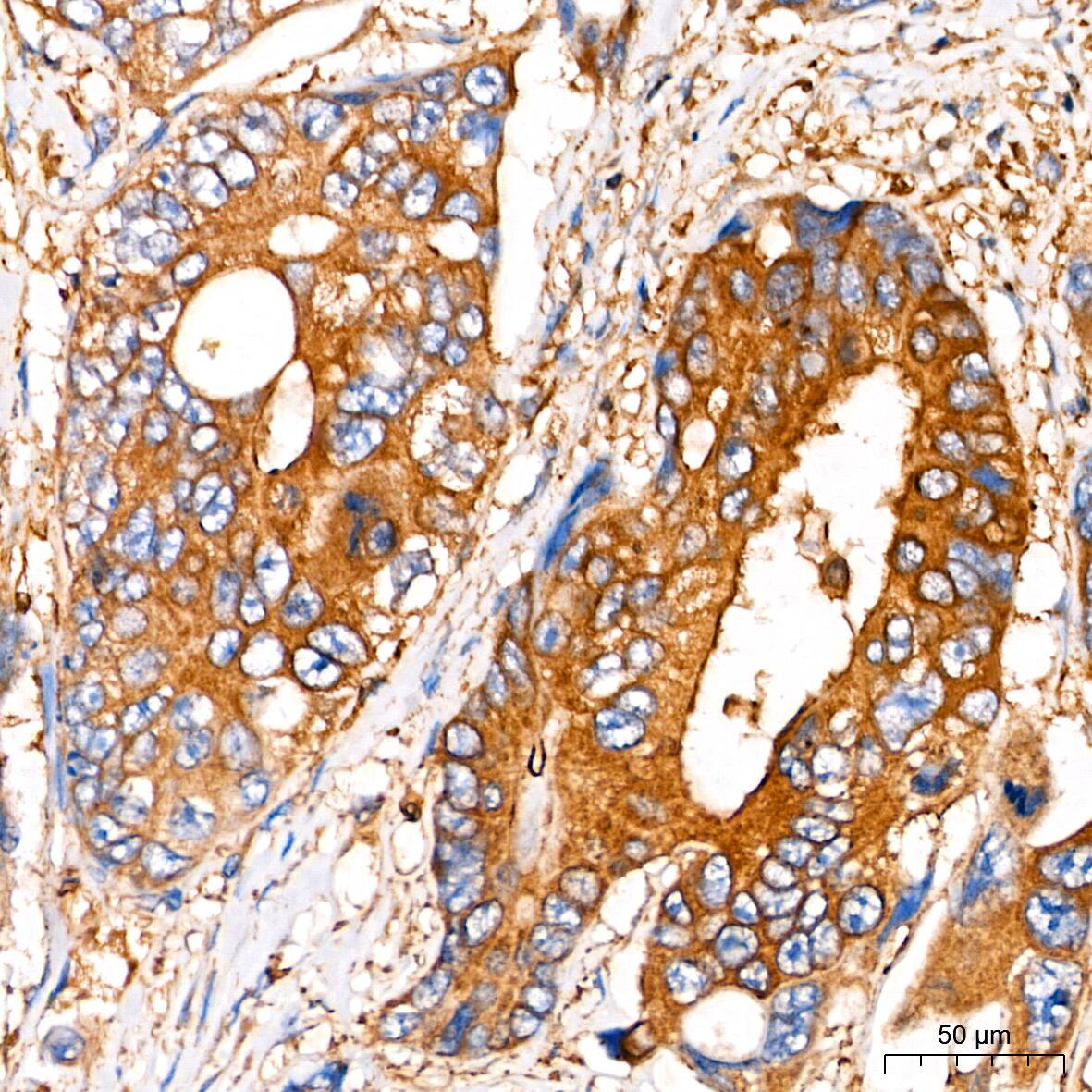 Insulysin/IDE Antibody - BSA Free