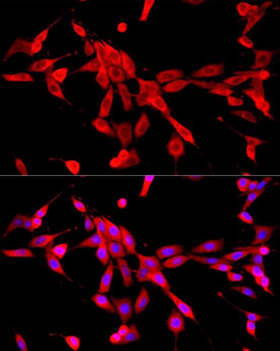 Cytochrome b245 alpha Antibody - BSA Free